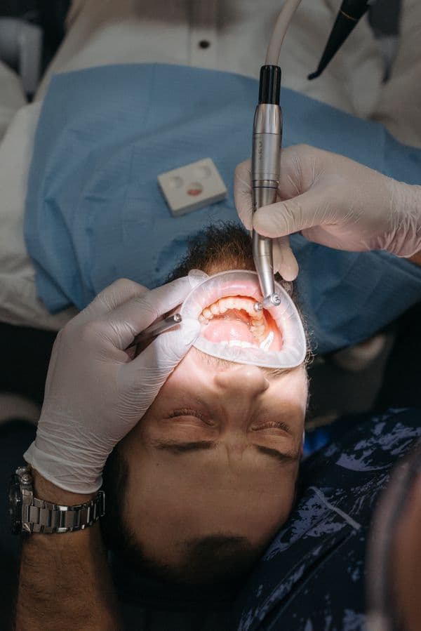 Tooth Fillings