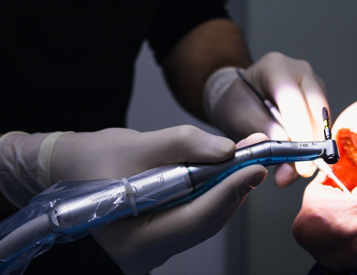 Root Canal Treatment